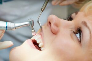 Igiene orale e prevenzione 2 Igiene orale e prevenzione